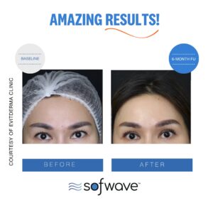 Set Eyebrow Skin Type