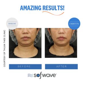 Set Lower Face Skin Type