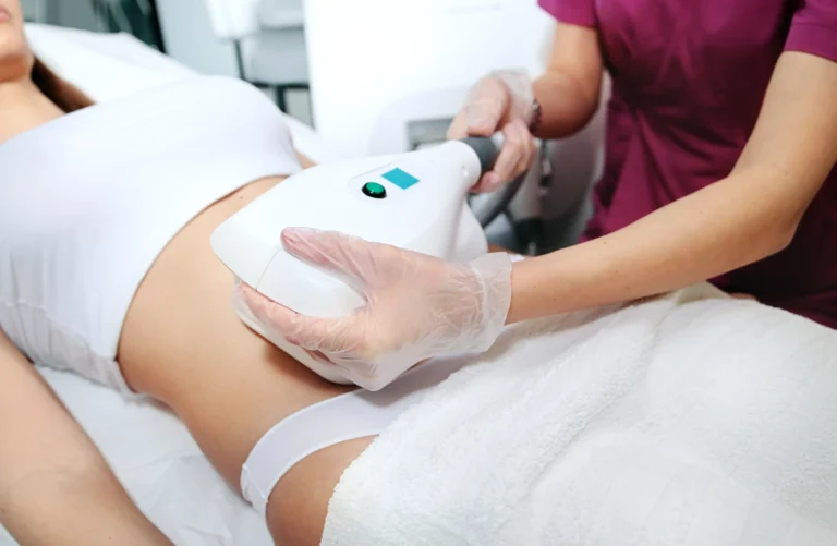 CoolSculpting procedure