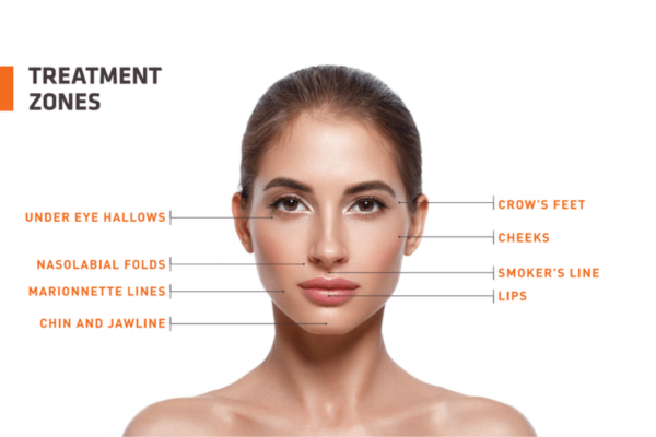 prf ez gel treatment zones